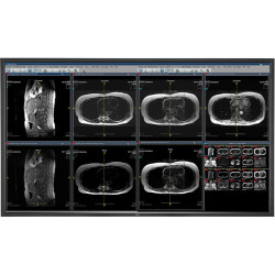 NEC MDC551C8 MDC551C8 55" 8MP Medical Clinical Color Display