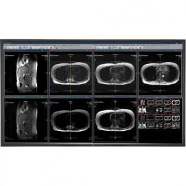 NEC MDC551C8 MDC551C8 55" 8MP Medical Clinical Color Display